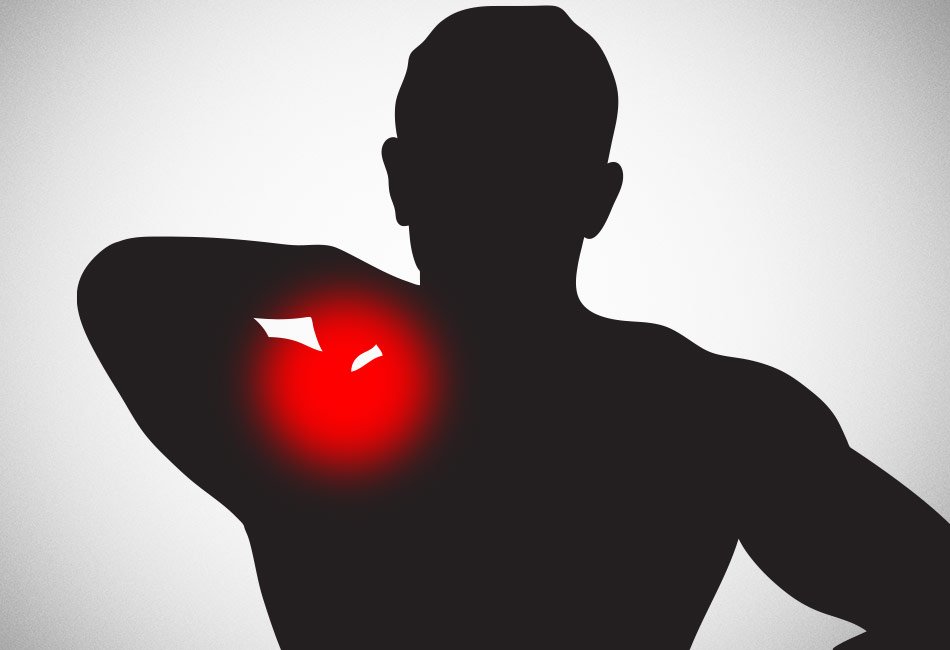 How to Recover from a Shoulder Injury